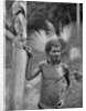 Malformation of the ears, Solomon Islands by JW Beattie