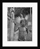 Malformation of the ears, Solomon Islands by JW Beattie