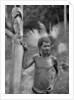 Malformation of the ears, Solomon Islands by JW Beattie
