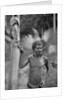 Malformation of the ears, Solomon Islands by JW Beattie