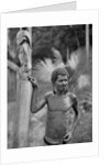 Malformation of the ears, Solomon Islands by JW Beattie
