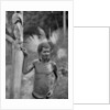 Malformation of the ears, Solomon Islands by JW Beattie