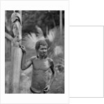 Malformation of the ears, Solomon Islands by JW Beattie