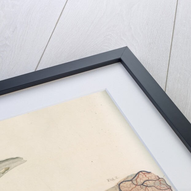 'Ossification of the dura and pia mater' by J Wedgewood