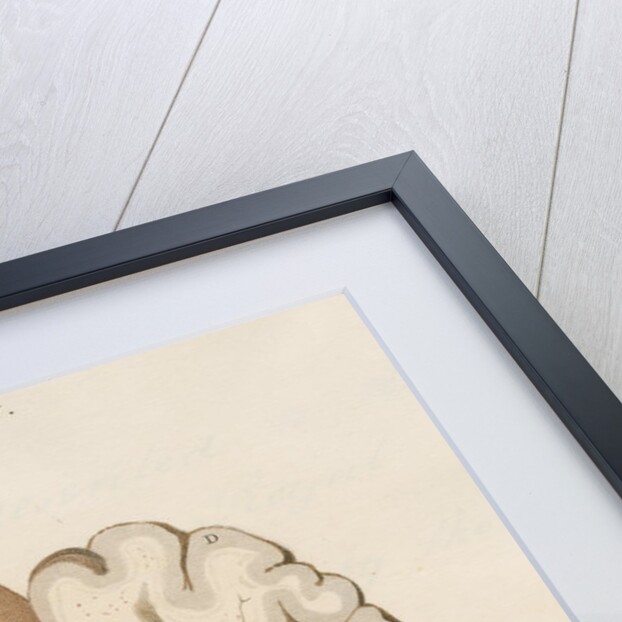 'Extravasation of the blood' by J Wedgewood