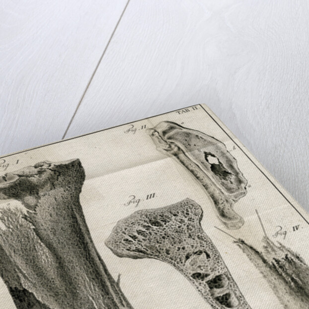 Sections of the Tibia by Faustino Anderloni
