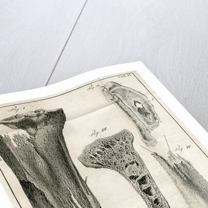 Sections of the Tibia by Faustino Anderloni