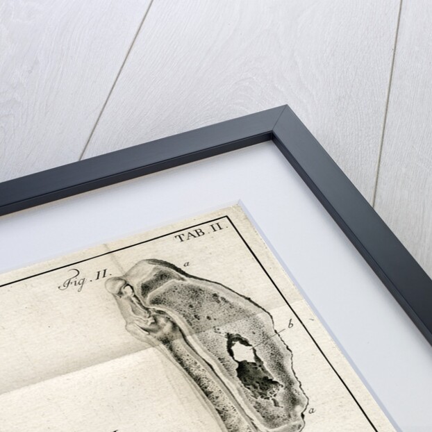 Sections of the Tibia by Faustino Anderloni