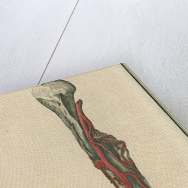 Dissection of an arm on which the operation for the Aneurism had been performed by unknown