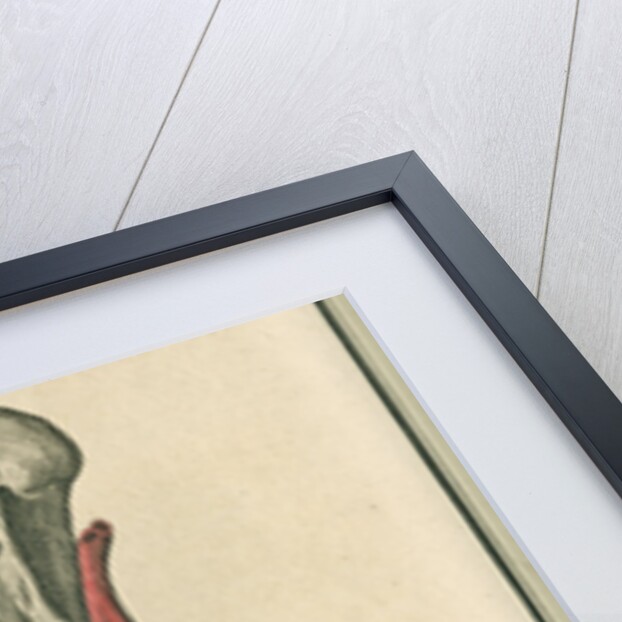 Dissection of an arm on which the operation for the Aneurism had been performed by unknown