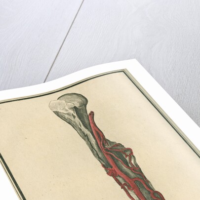 Dissection of an arm on which the operation for the Aneurism had been performed by unknown