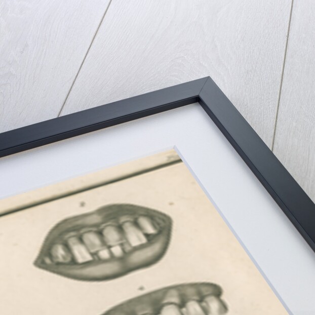 Irregularities of the teeth by Parks