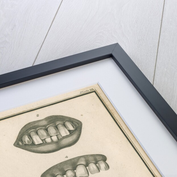 Irregularities of the teeth by Parks