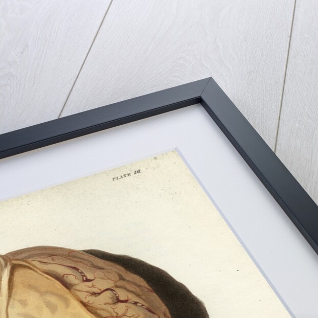 'Effects of jaundice on the brain and its membranes' by William Thomas Fry