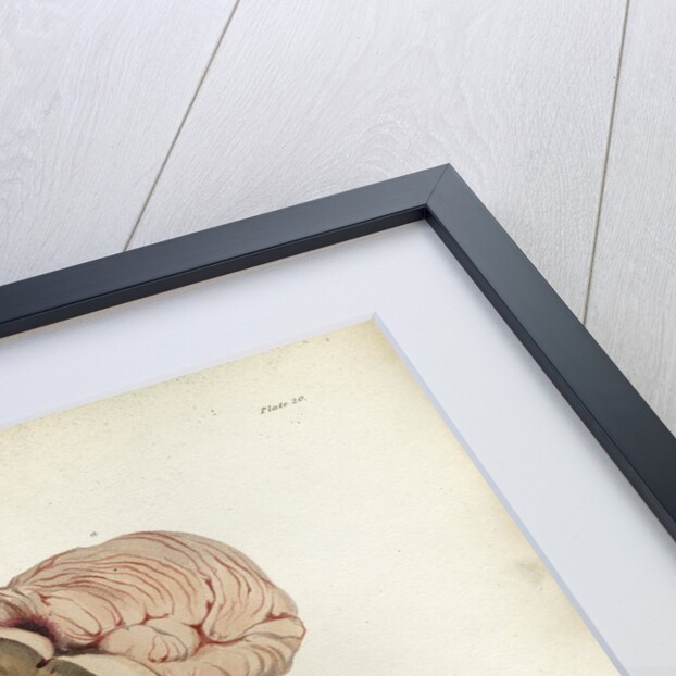 'Apoplexy and concussion' by C J Canton