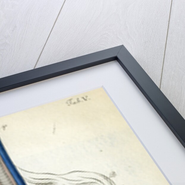 View of the chest cavity by Walwert