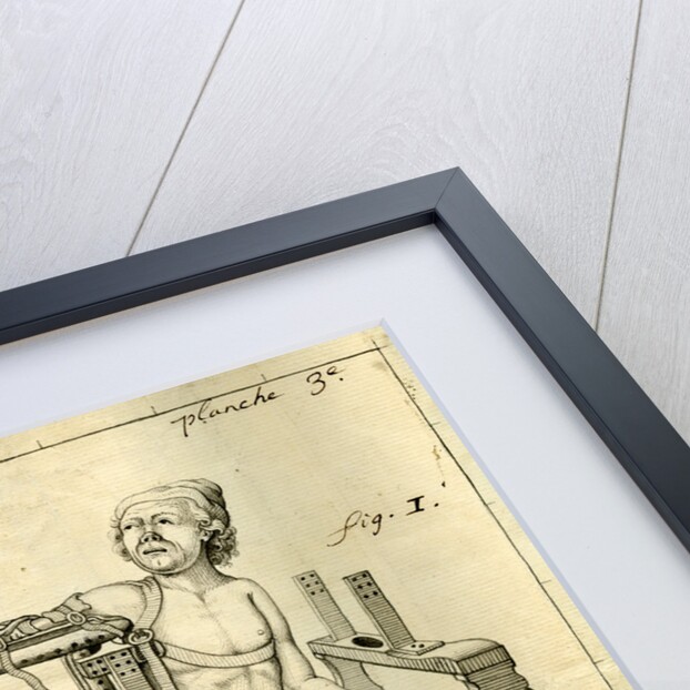 'Ambe of Hippocrates': contraption for repairing dislocated shoulders by Claude-Nicholas Le Cat