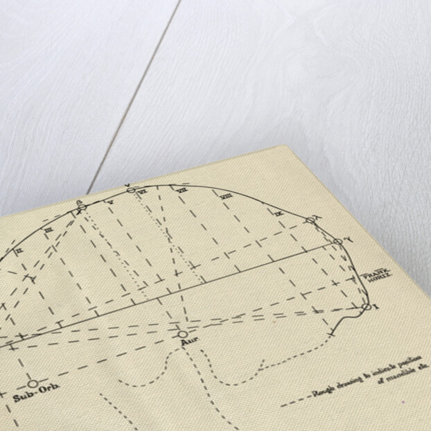Measurements of Robert the Bruce’s skull by Unknown