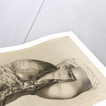 Human gravid uterus by II Scotin