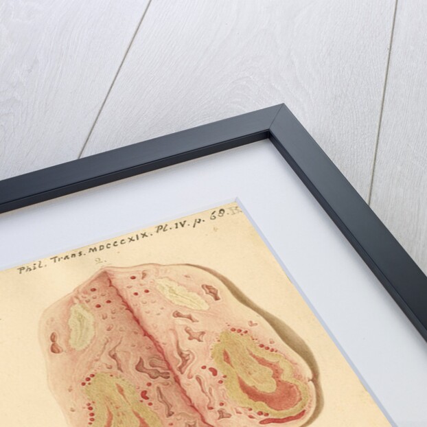 Human ovary and corpus luteum during and after pregnancy by Franz Andreas Bauer