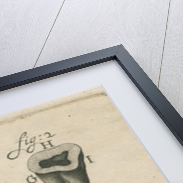 Microscopical observations of the structure of human teeth by Anonymous