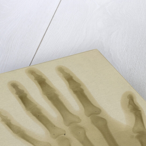 X-ray photograph of the hand of Arthur James Balfour by Alan Archibald Campbell Swinton