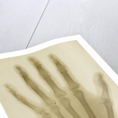 X-ray photograph of the hand of Arthur James Balfour by Alan Archibald Campbell Swinton