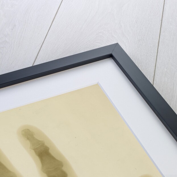 X-ray photograph of the hand of Arthur James Balfour by Alan Archibald Campbell Swinton