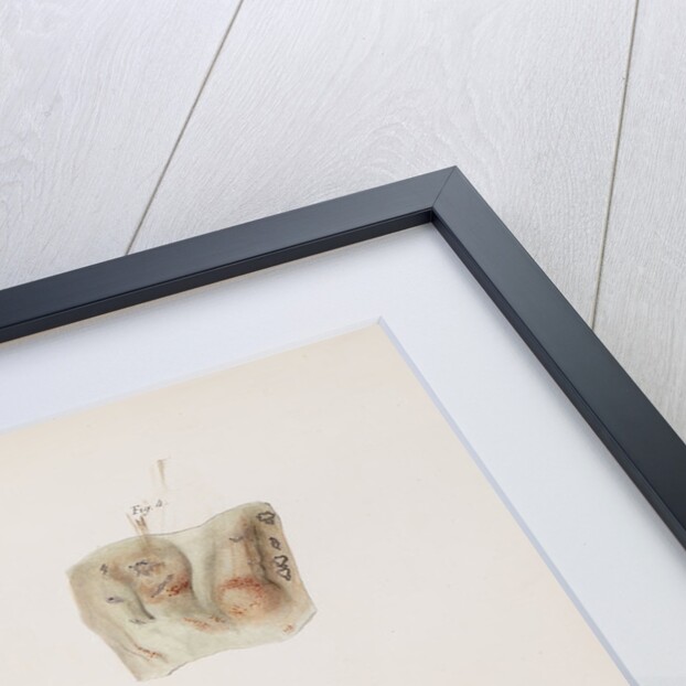 Alterations caused by cholera in the intestinal mucous membrane by d'Harlingue