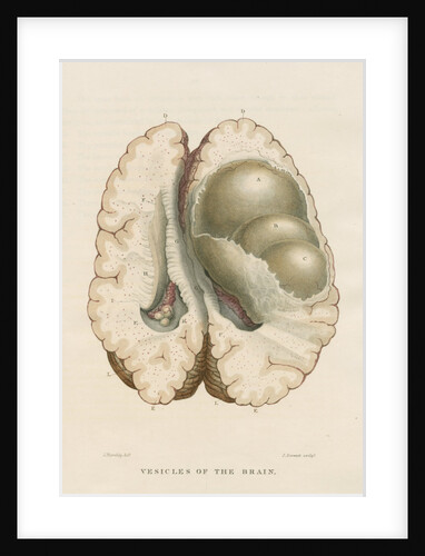 'Vesicles in the cerebrium' by J Stewart senior
