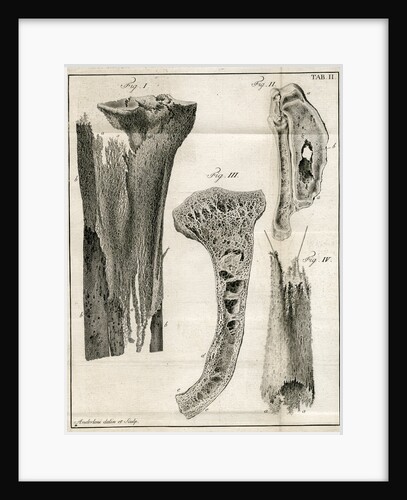 Sections of the Tibia by Faustino Anderloni