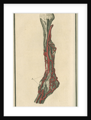 Dissection of an arm on which the operation for the Aneurism had been performed by unknown