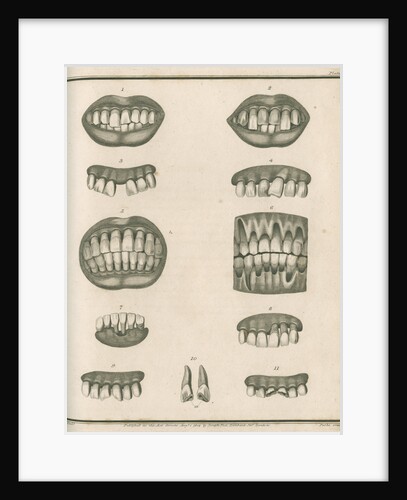 Irregularities of the teeth by Parks