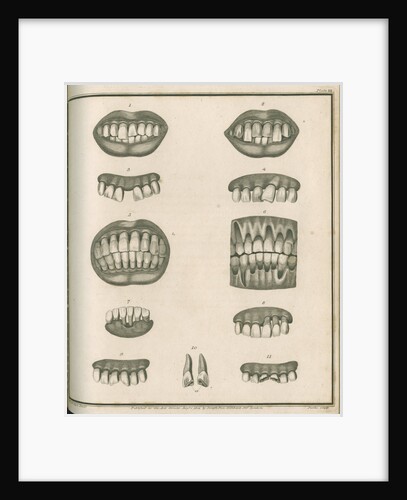 Irregularities of the teeth by Parks