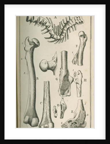 Various human bones by Sutton Nicholls