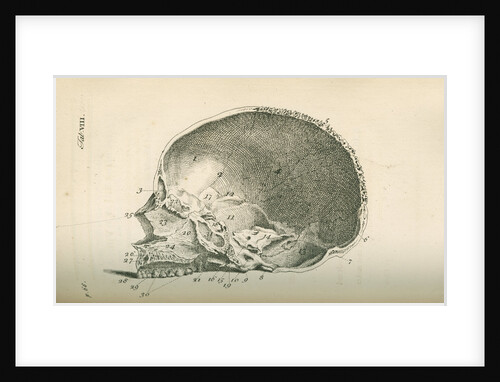 The inside of a skull sawed longitudinally by unknown