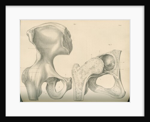 Hip bone and a portion of the femur by J Perry