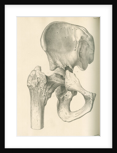Front view of the right hip and femur by J Perry