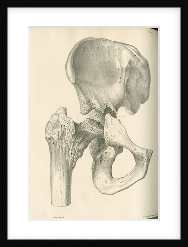 Front view of the right hip and femur by J Perry