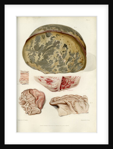 Parts of the brain including the dura mater by William Say