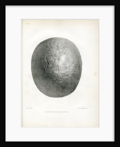 'Epilepsy' by Godefroy Engelmann