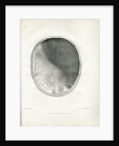 'Epilepsy' by Godefroy Engelmann