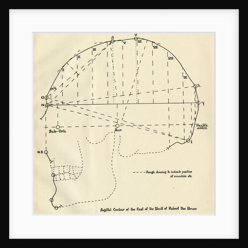 Measurements of Robert the Bruce’s skull by Unknown