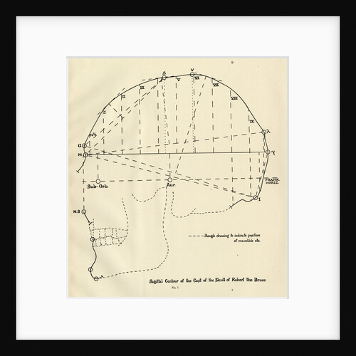 Measurements of Robert the Bruce's skull by unknown