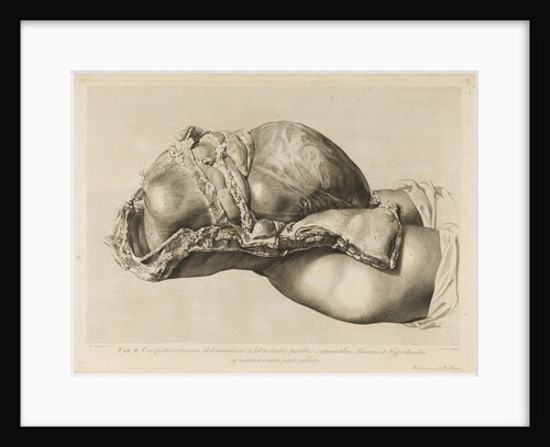 Human gravid uterus by II Scotin