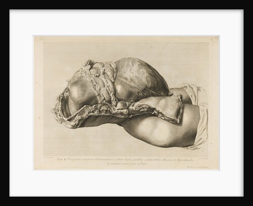 Human gravid uterus by II Scotin