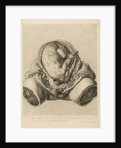 Foetus in the womb by Robert Strange