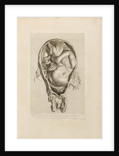 Foetus in the womb by Jean-Baptiste Michel