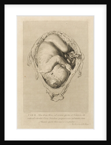 Foetus in the womb by Henry Bryer