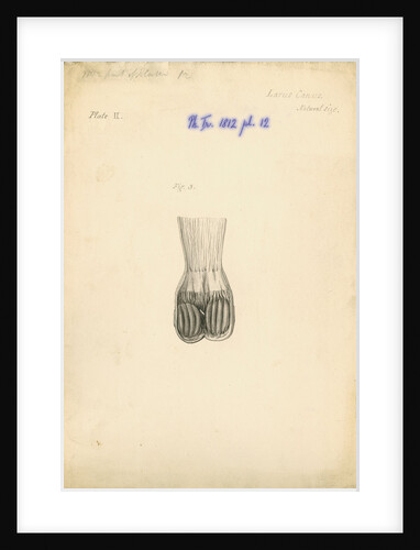'Larus canus [Common gull gizzard]' by William Clift